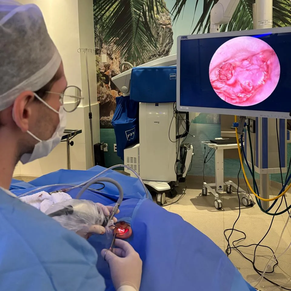 Dr. Caio Alves operando o ouvido por via endoscópica, com o campo cirúrgico ampliado no monitor